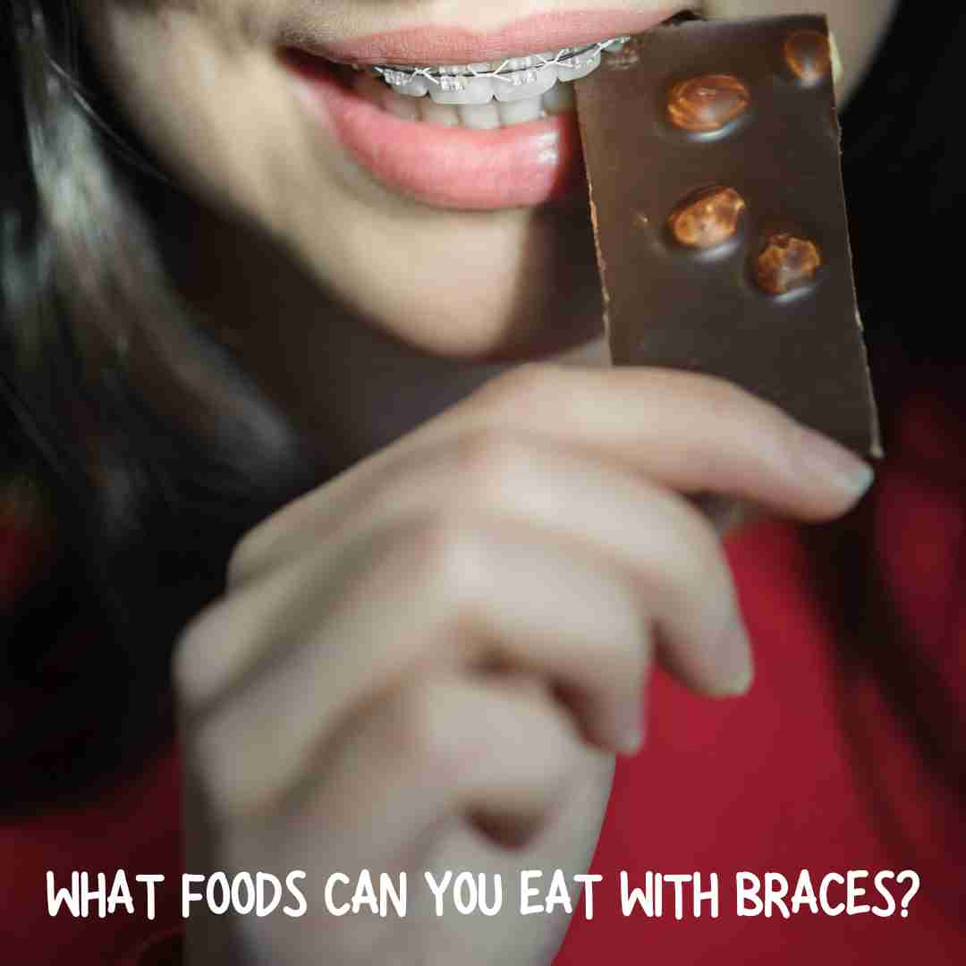 What Foods Can You Eat With Braces